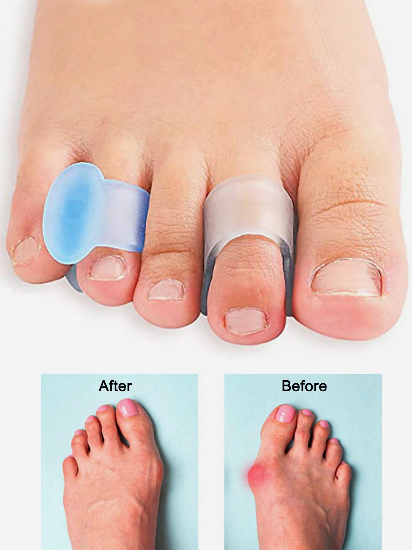 فاصل أصابع القدم من الجل، 4 قط - مراجعة Yoga Toe Separator وسعره